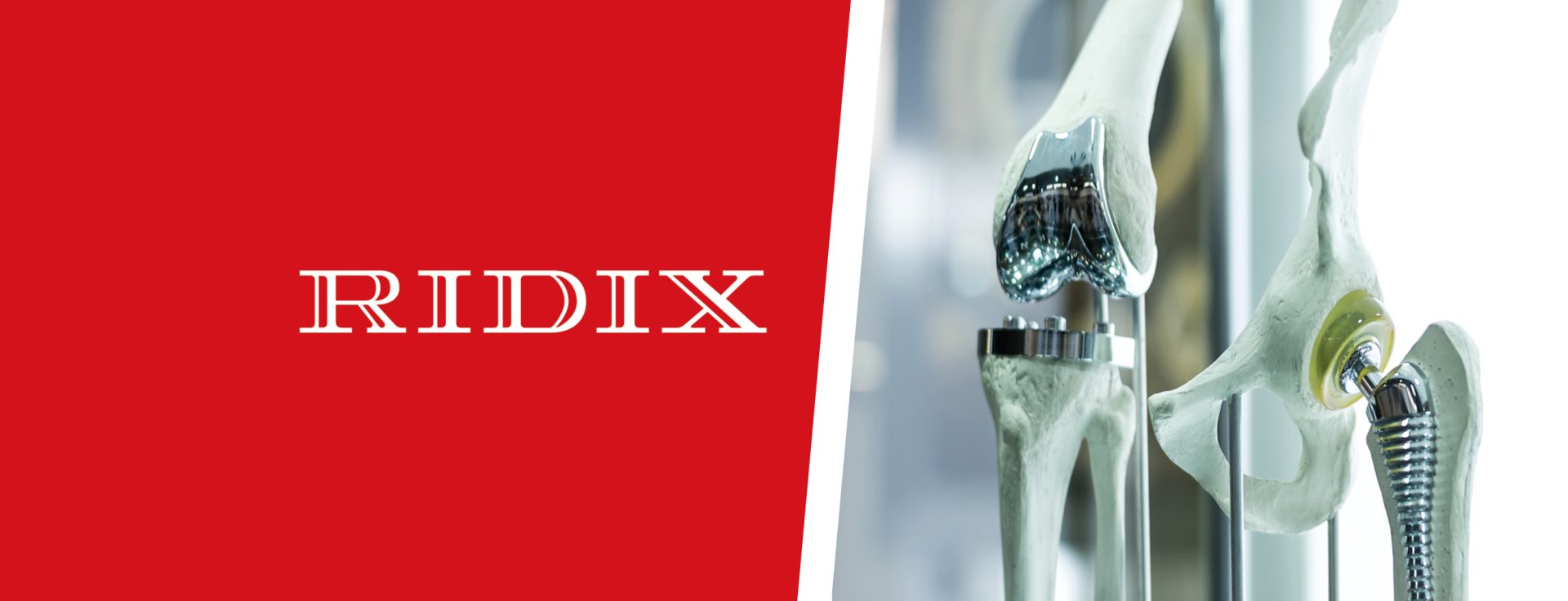 Ridix offre ai suoi clienti un pacchetto completo di soluzioni per il settore medicale: stampanti 3D, polveri di leghe metalliche, utensili di precisione, oli industriali, marcatrici industriali per la codifica UDI, software per l'elaborazione dati 3D.